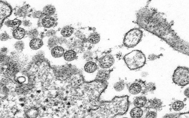 Tribe reports coronavirus patients had to be sent to Minnesota